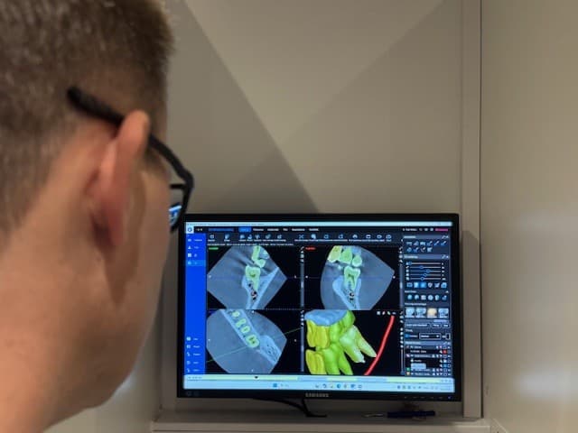 CBCT-røntgen hos Tandlægerne Torvet I:S